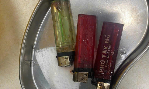 Three lighters removed from man's stomach