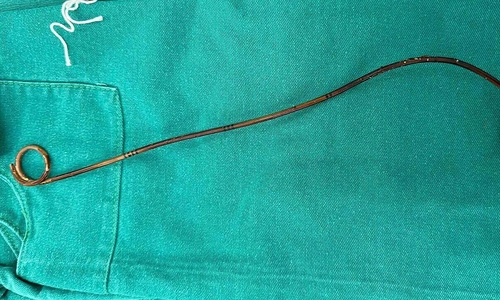 Stent forgotten in man's body for two years