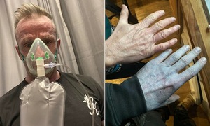 Hospital staff in panic after man's skin turns blue like an Avatar character