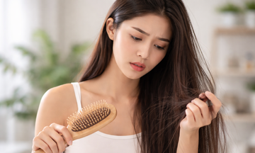 Hormonal imbalance in women can cause hair loss