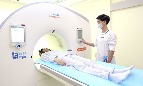 Is regular lung cancer screening necessary after five years of quitting smoking?