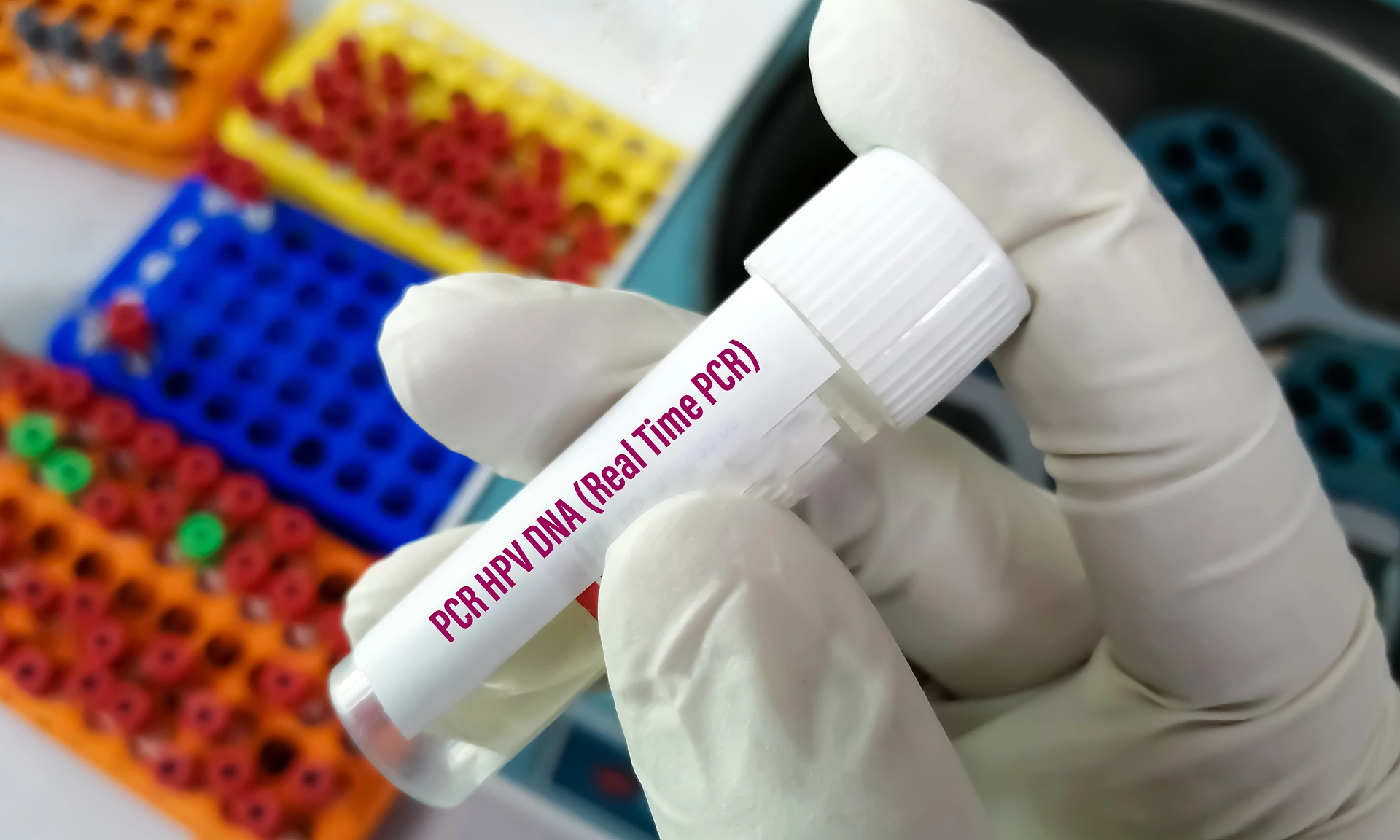 Is it harder for men or women to clear the HPV virus?
