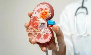 Chinese doctor warns of five signs of late-stage kidney disease