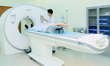 Headaches: an early warning sign of stroke