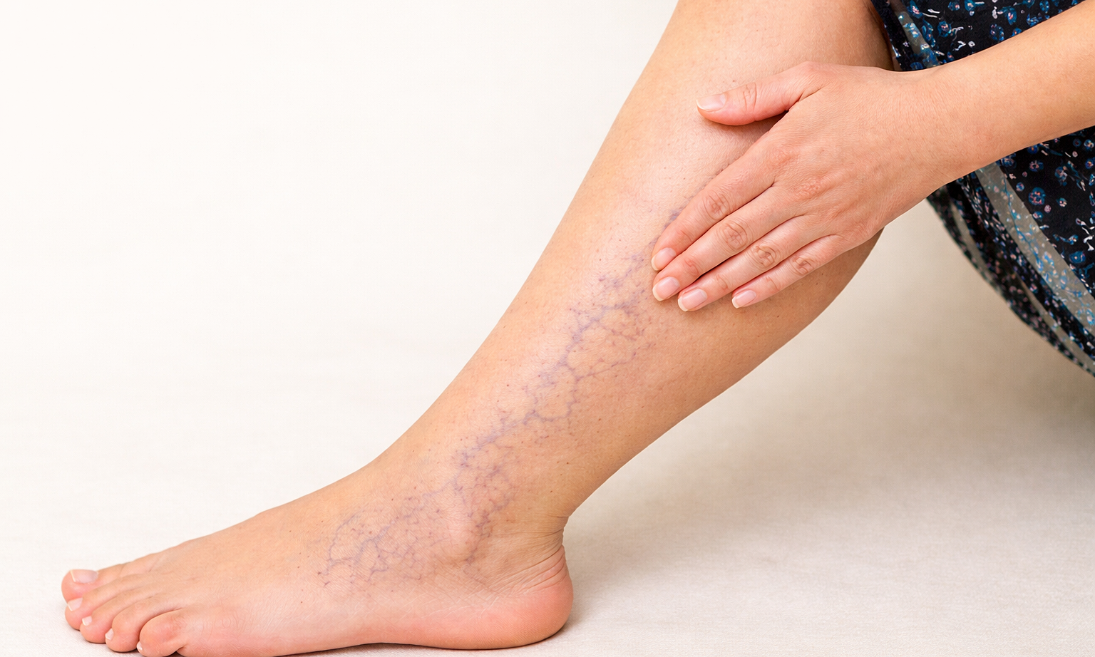 Causes of chronic venous insufficiency