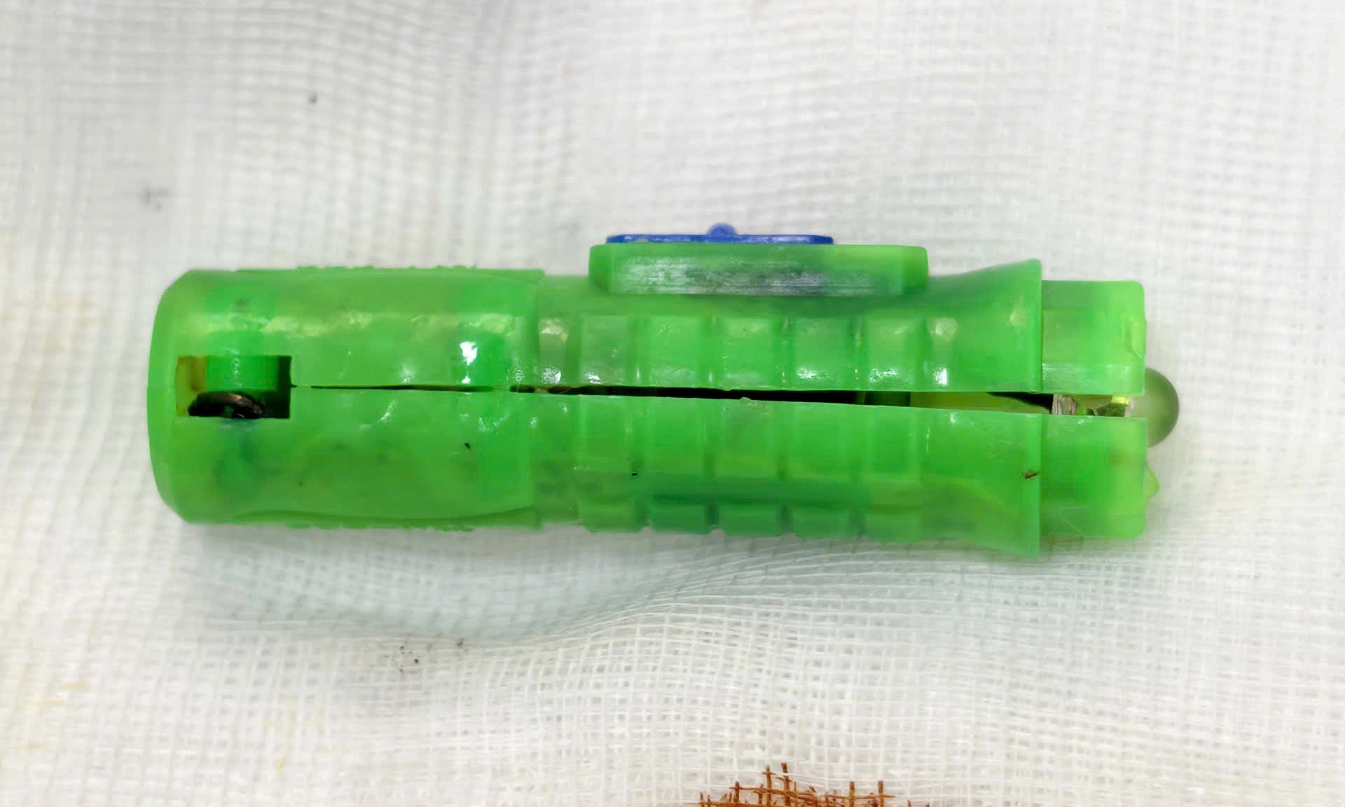 Rusted foreign object in girl's body for 5 months