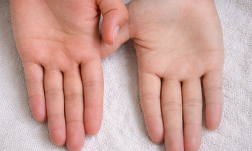 Signs of iron deficiency in the body