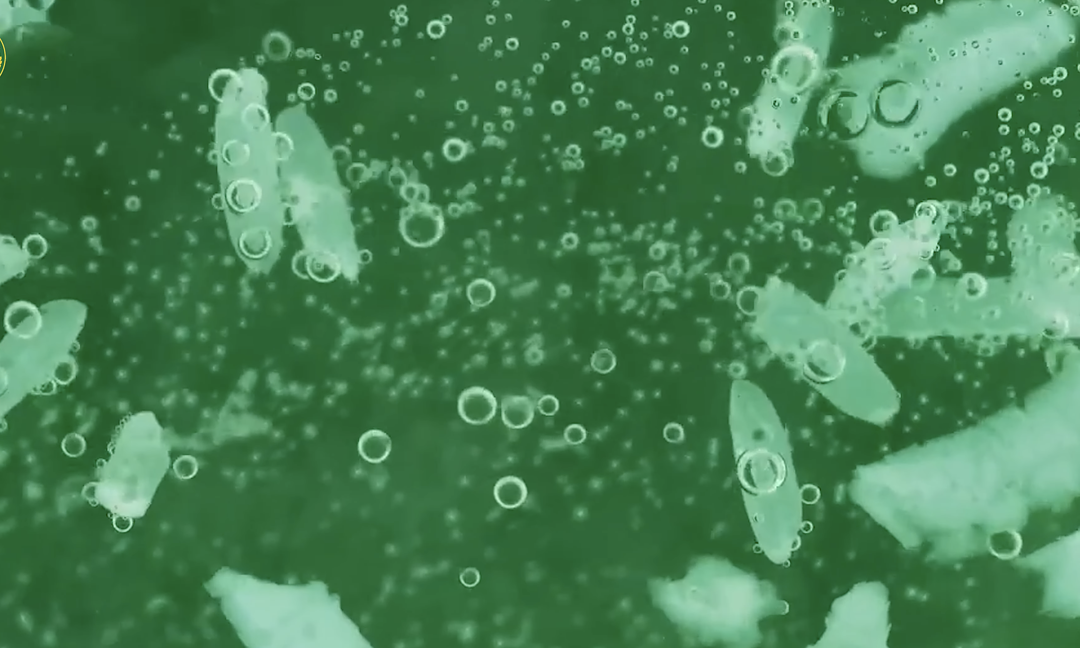 Man loses arm to 'flesh-eating bacteria' infection