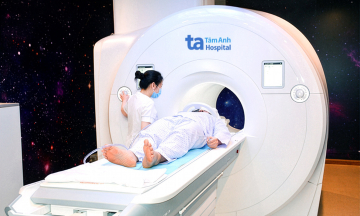 Dementia due to neurodegenerative brain disease