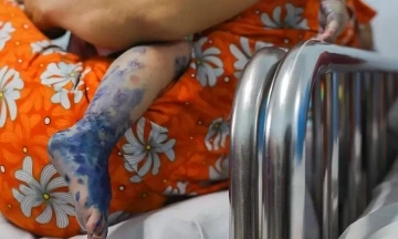 Hand, foot, and mouth disease cases surge, Ho Chi Minh City records two child deaths