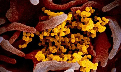 Covid "Cicada" hyper-mutant variant spreading in the US