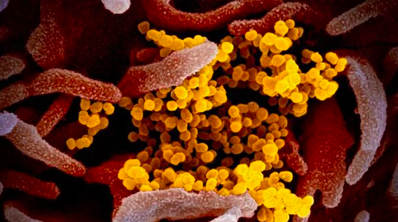 Ministry of Health: 'Do not be complacent with the Cicada Covid variant'