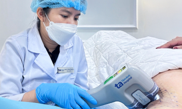 Treating hyperhidrosis with microwave technology