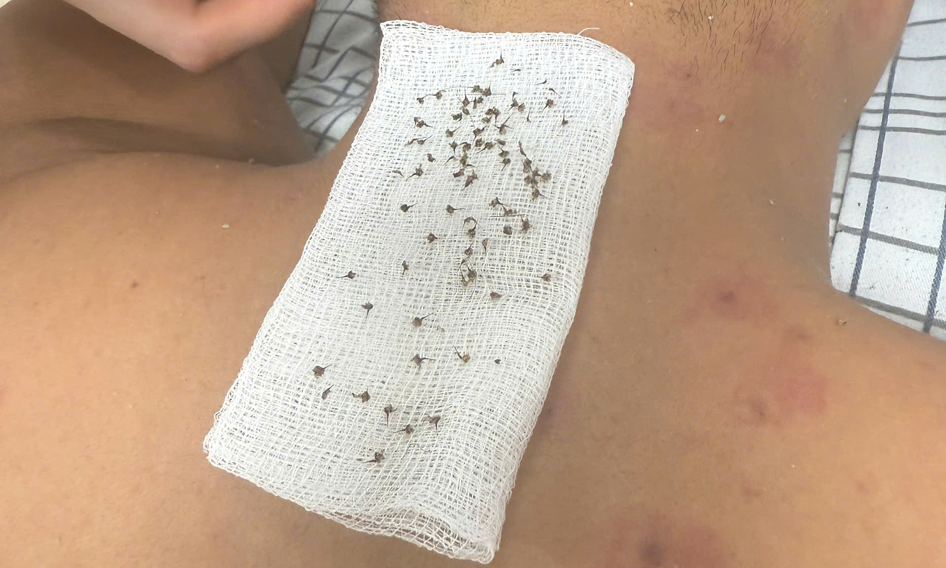 Father and son suffer hundreds of honey bee stings