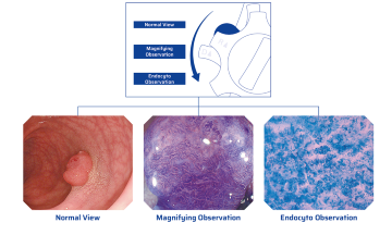 Cellular-level digestive endoscopy deployed for the first time in Vietnam