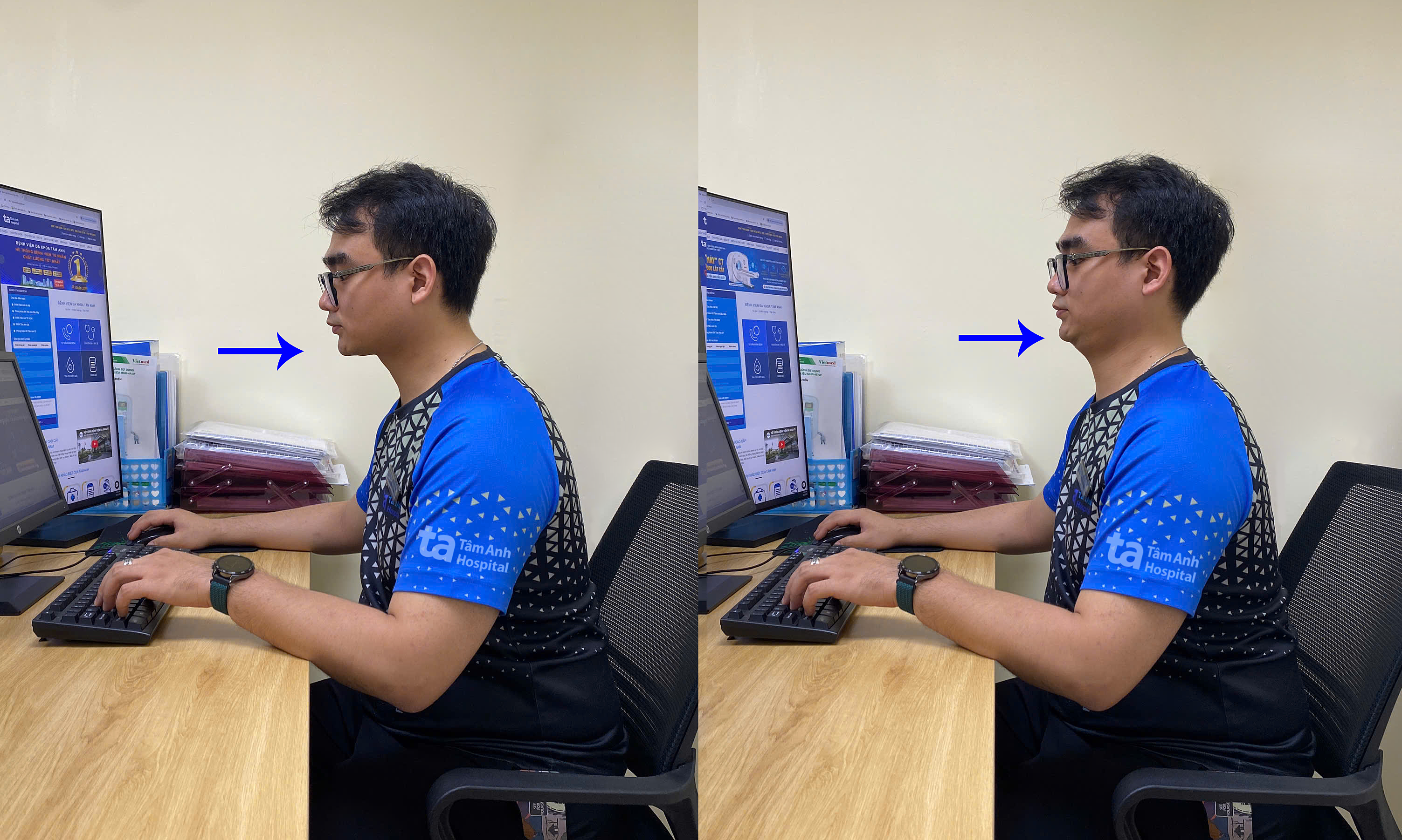 Three exercises to reduce neck, shoulder, and upper back fatigue for office workers