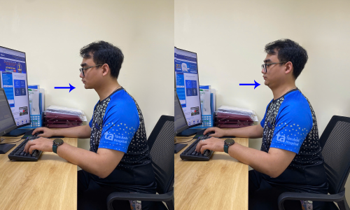 Three exercises to reduce neck, shoulder, and upper back fatigue for office workers