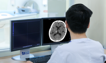 Cerebral hemorrhage due to hypertension