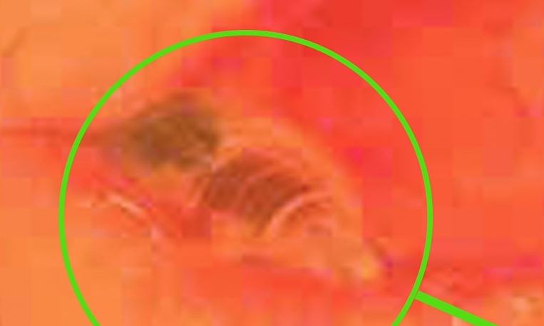 A dead bee stuck for 24 hours in a woman's eye