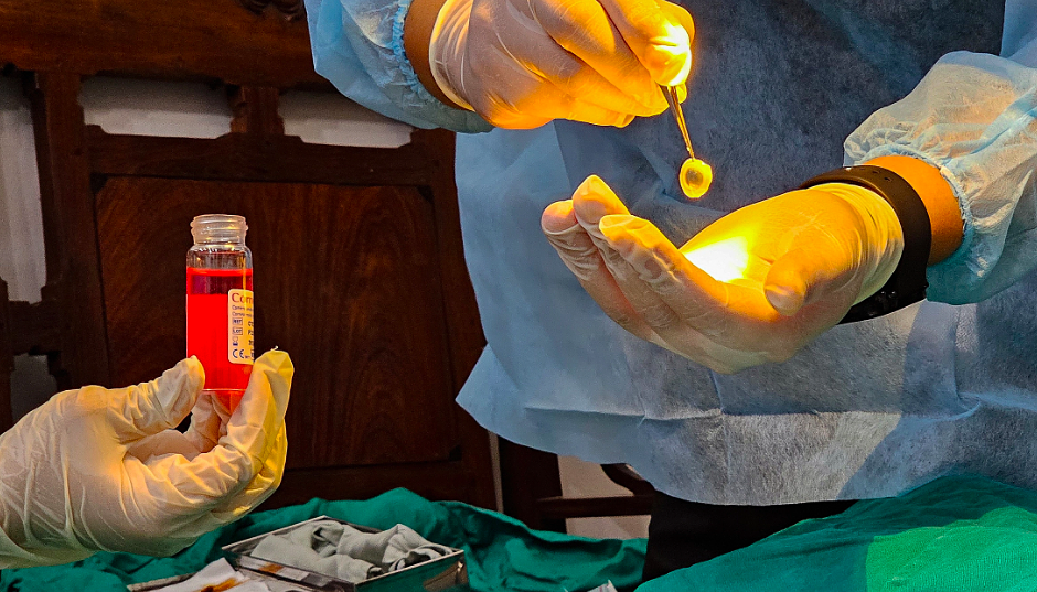 More than 500,000 Vietnamese people need corneal transplants