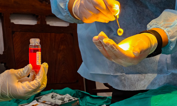 More than 500,000 Vietnamese people need corneal transplants