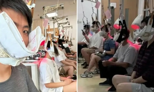 The danger of full-body paralysis from the 'neck hanging' health trend