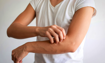 Itchy skin at night – an easily overlooked sign of kidney failure