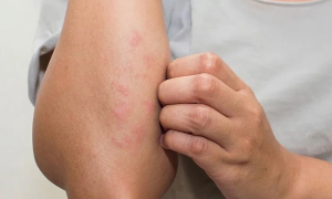 7 silent symptoms warning of kidney failure