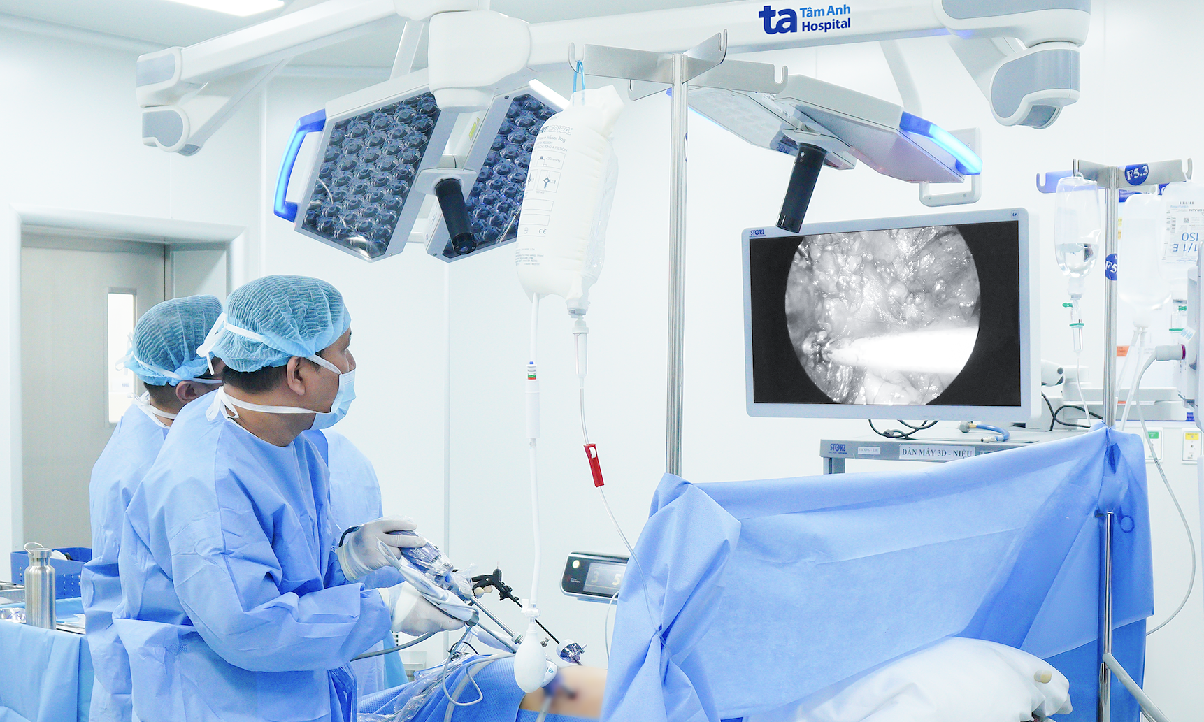 Kidney-sized fatty tumor removed