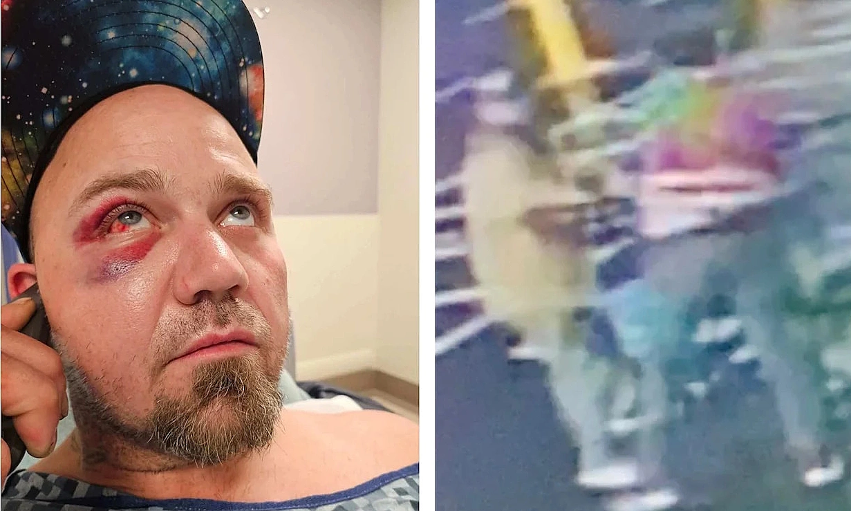 Shoplifter sues supermarket employee after being chased and beaten