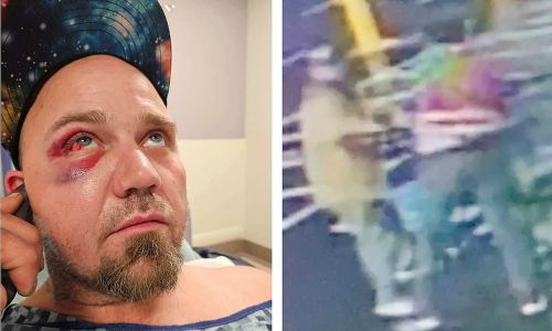 Shoplifter sues supermarket employee after being chased and beaten