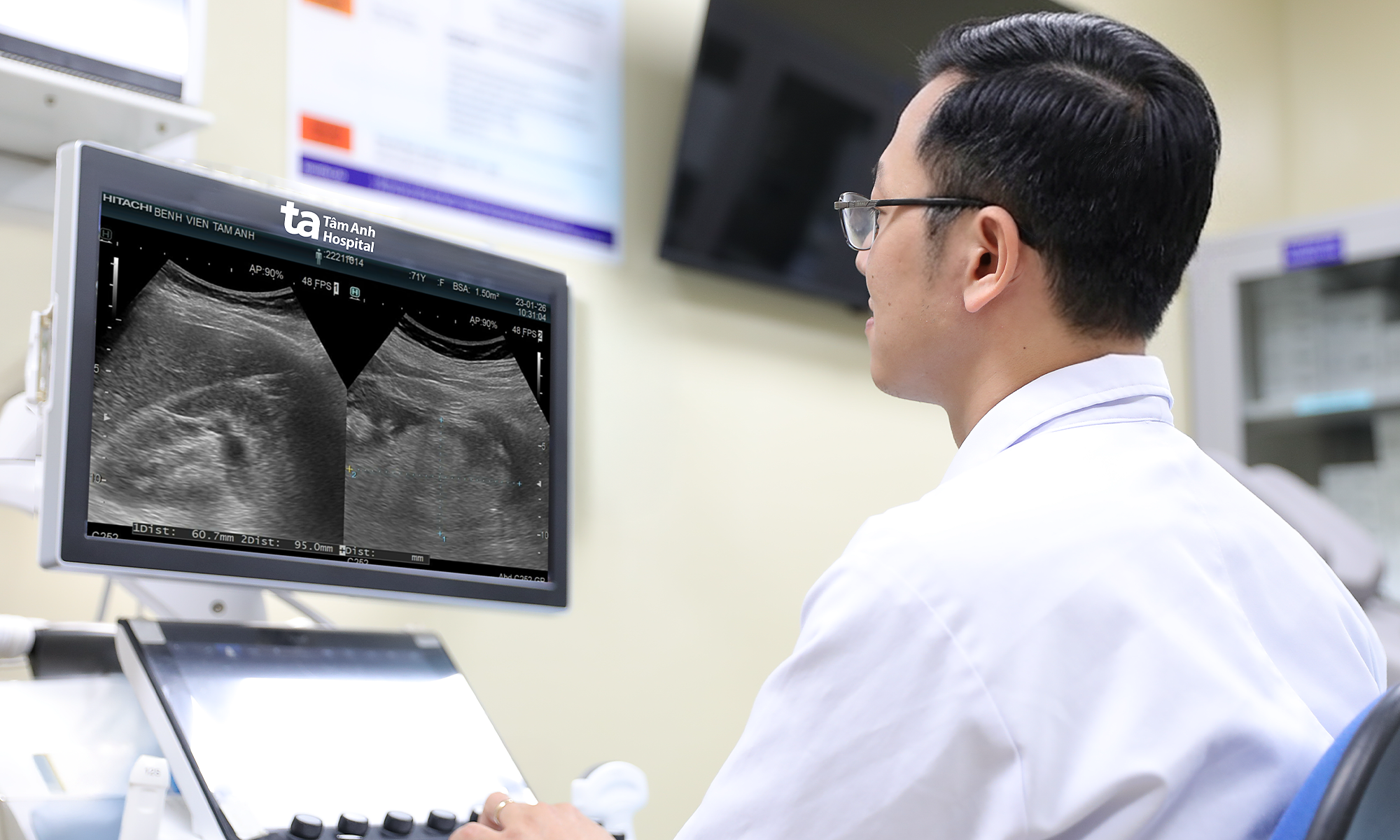 Sudden kidney tumor rupture causes hemorrhage