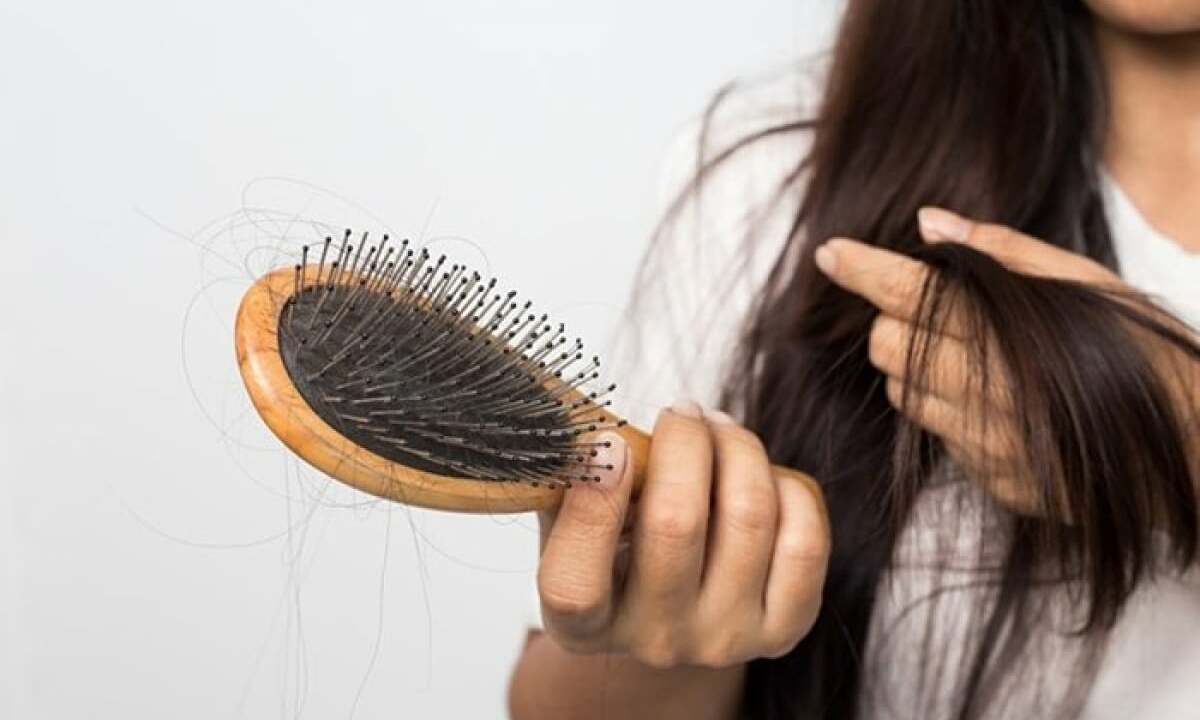 Is significant hair loss a sign of hypothyroidism?