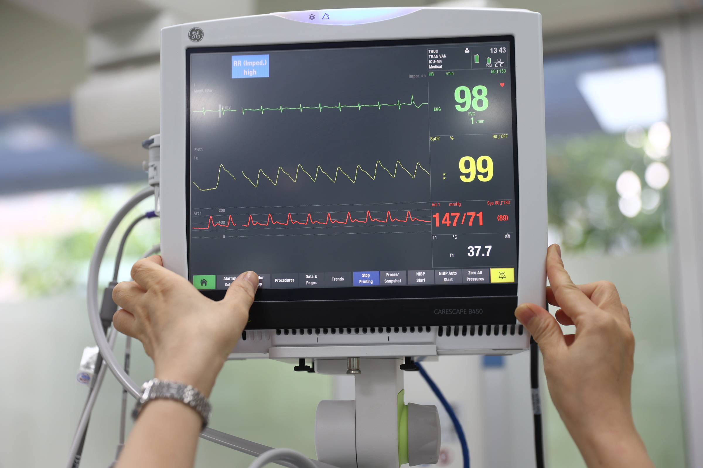 Four victims in 4-story house fire face 'severe prognosis'