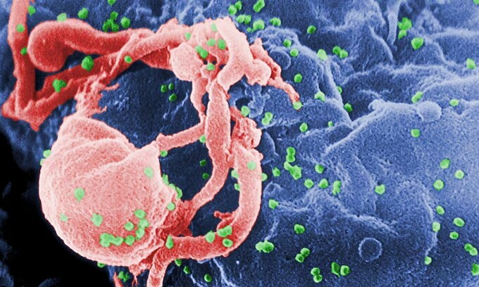 Norwegian patient cured of both HIV and cancer thanks to rare gene from brother