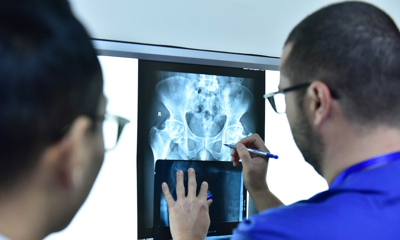 Doctors predict increase in hip replacement cases over next 10 years