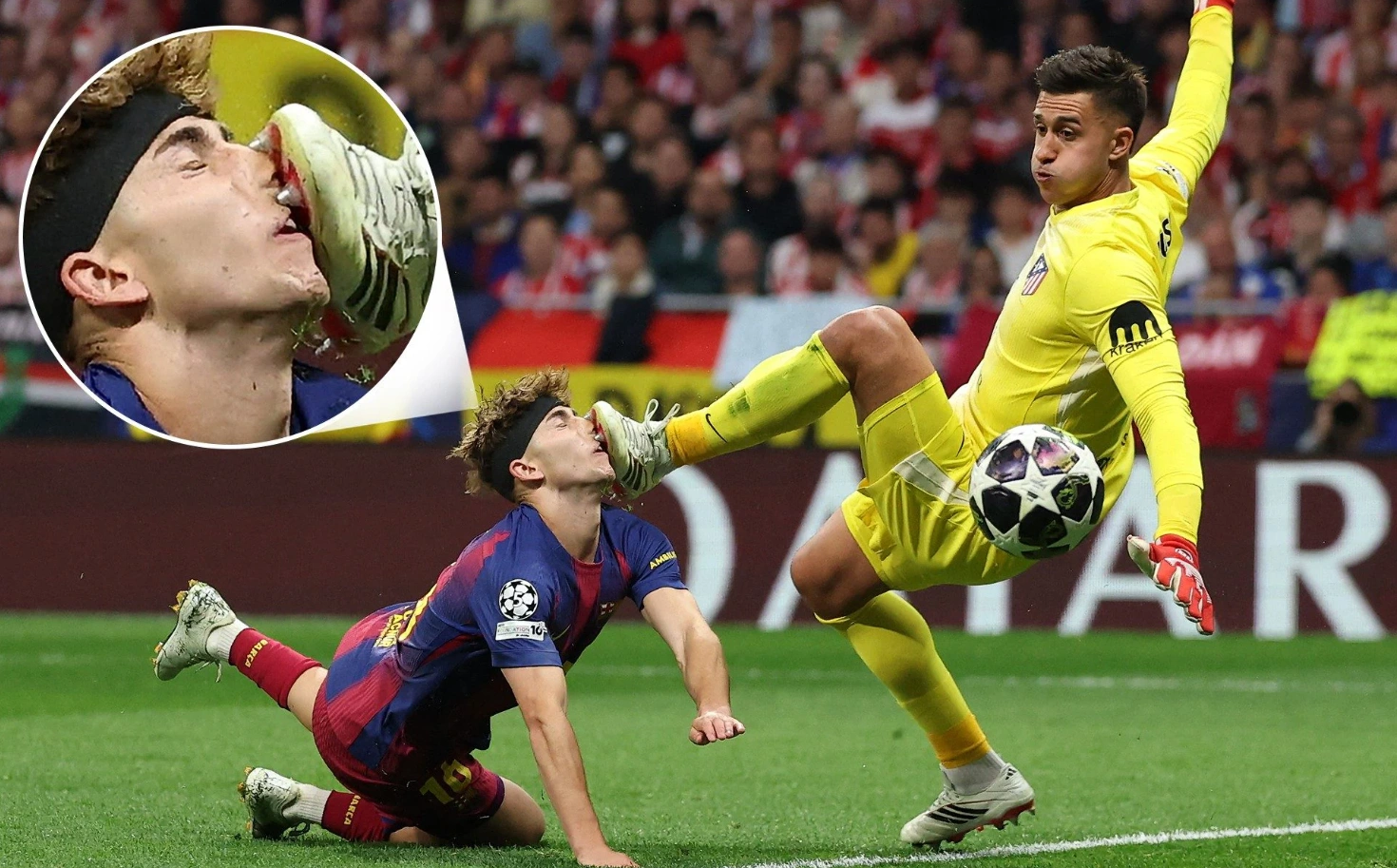 Barca midfielder bleeds after being kicked in the face