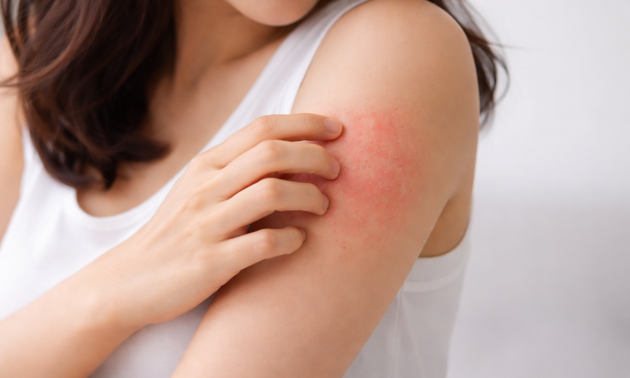 Five skin changes that may signal liver disease