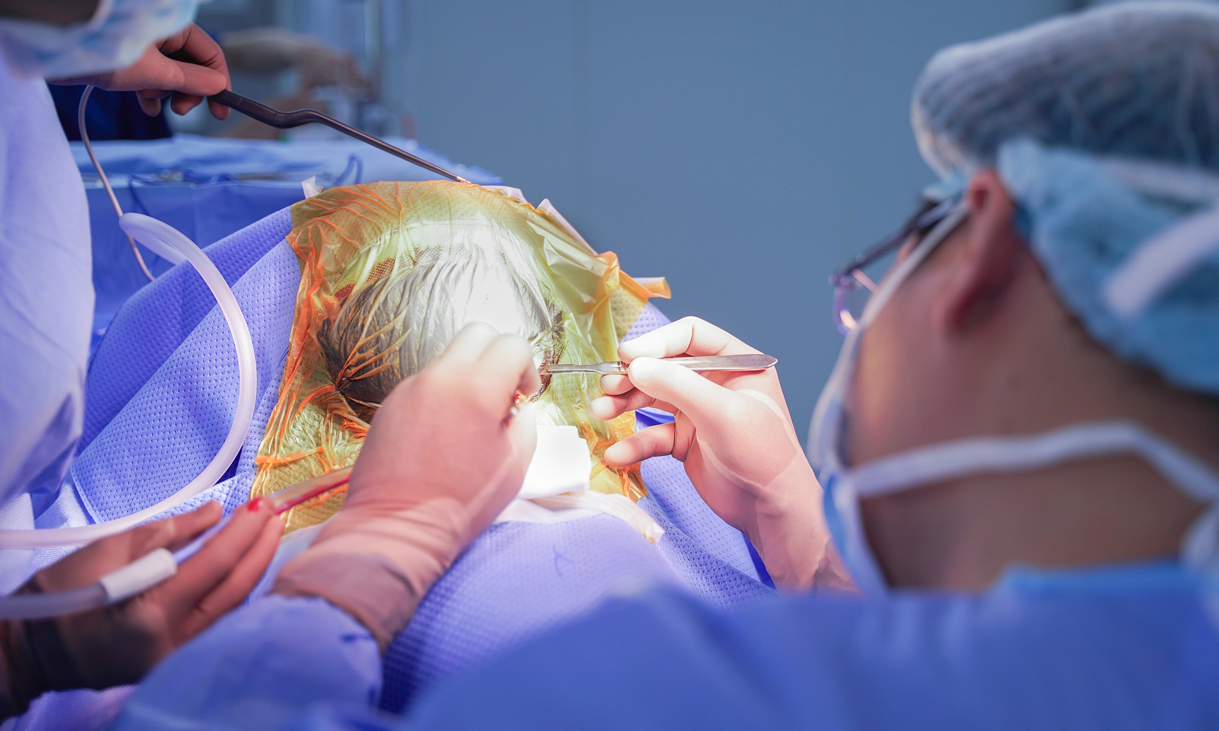 Foreign patient saved after multiple glass fragments embed in skull