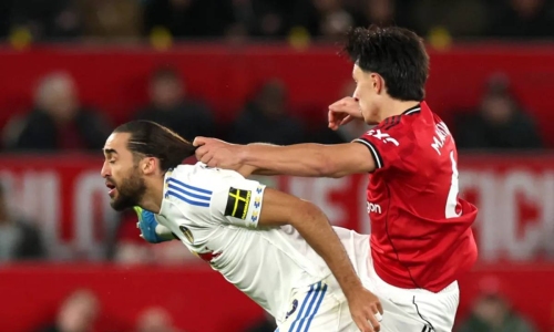 Six most notorious hair-pulling incidents in English football