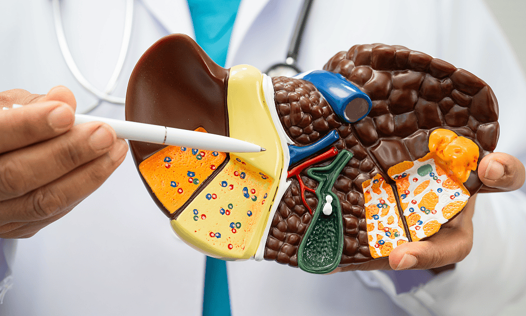 Young man recovers from liver fibrosis by quitting daily bubble tea habit