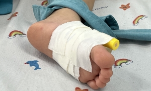 5 key points about hand-foot-and-mouth disease caused by EV71 virus