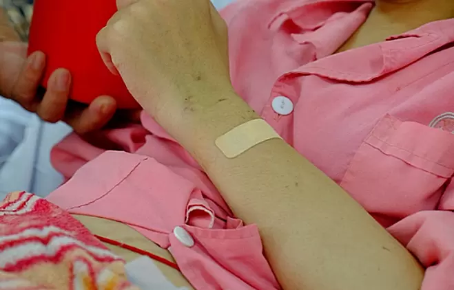 Vague symptoms cause lupus patients to miss golden treatment window