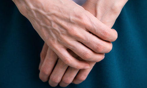 Signs your body is aging faster than its chronological age