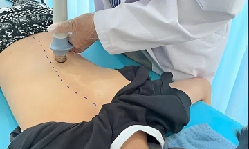 Scoliosis linked to leg length discrepancy