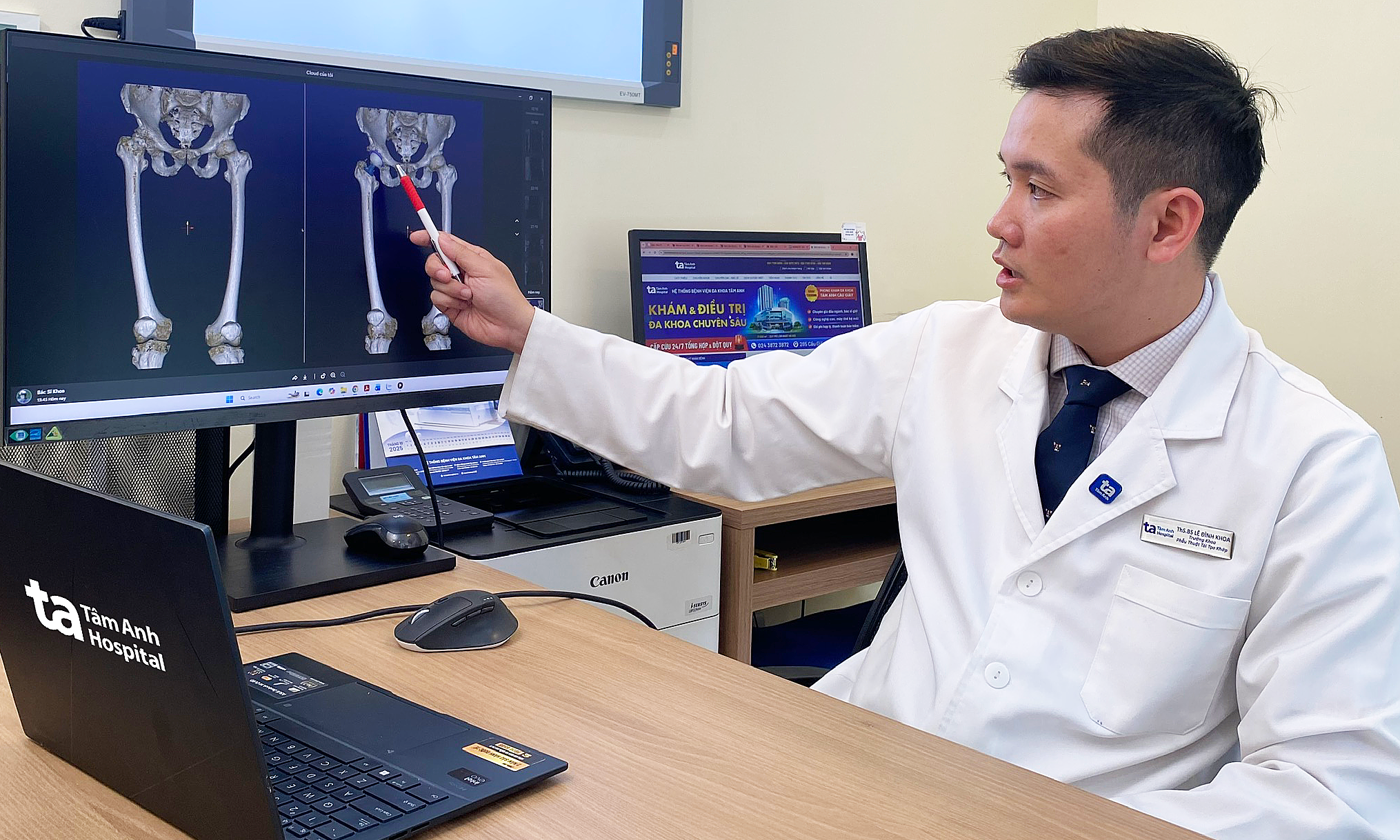 Does joint replacement cause a foreign body sensation in the leg?