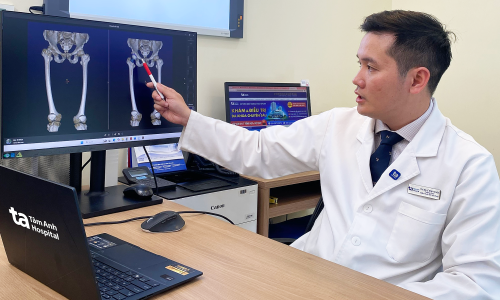 Does joint replacement cause a foreign body sensation in the leg?