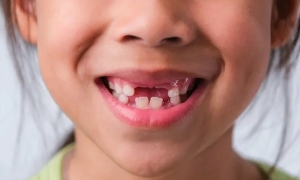 'Golden 30 Minutes' to Save a Child's Knocked-Out Permanent Tooth