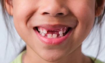 'Golden 30 Minutes' to Save a Child's Knocked-Out Permanent Tooth