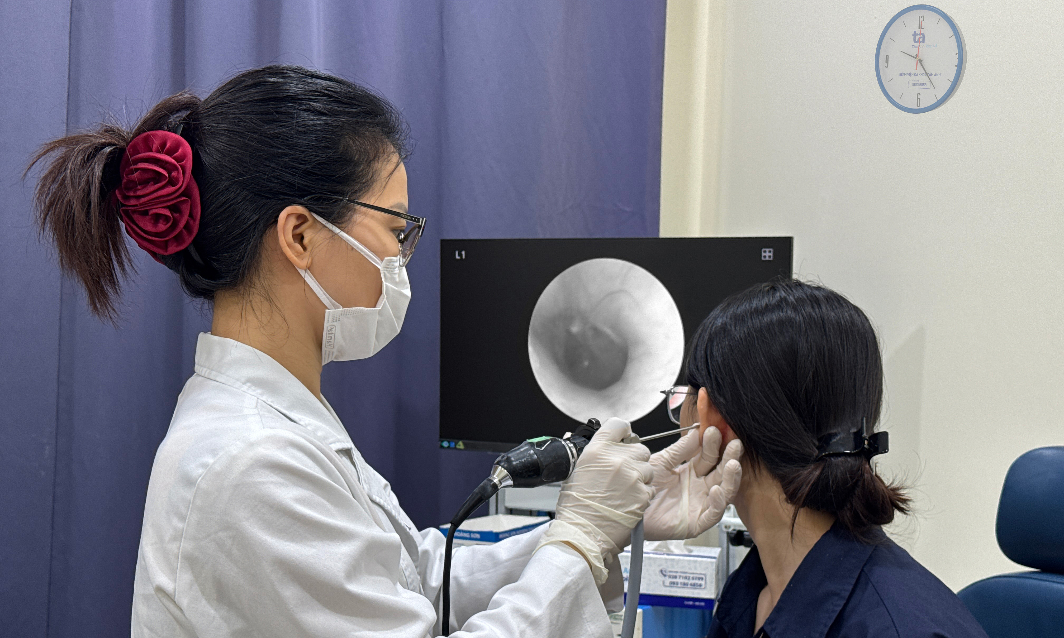 Outer ear infection caused by feather ear cleaning